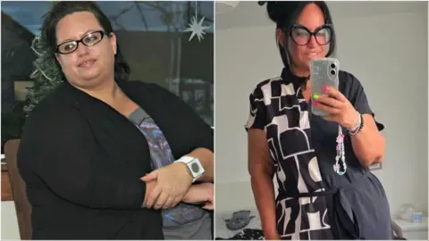 They Dropped Pounds With Jabs – Followed By the Excess Skin